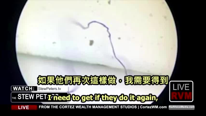 Dr Carrie Madej 逆苗樣本中發現驚人的納米機器寄生蟲，Transhuman 超人類的實驗性產物