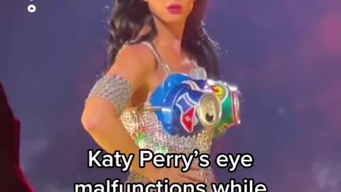 Katy Perry's eye malfunctions while on stage