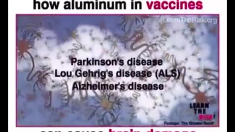 Leading expert explain how aluminum in vaccine