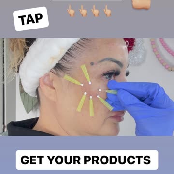 Cheek, enhancement video coming soon