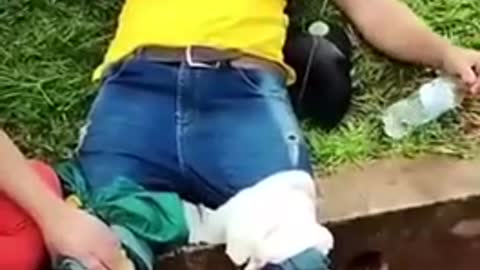 Injured Brazilian live from Brazil it has begun