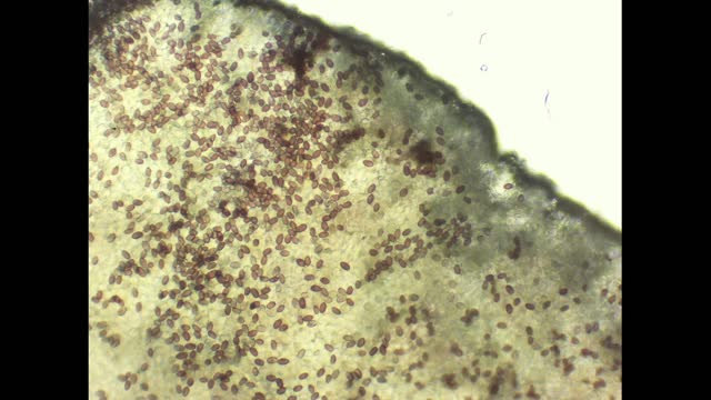 microscope mycology