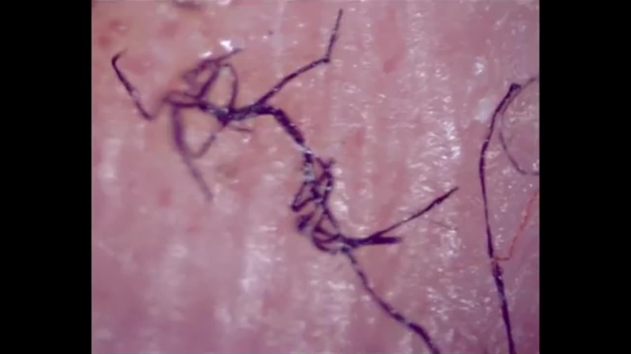 Jeff & Cliff Mickelson - Morgellons Nano Fibers And Nano Smart Dust