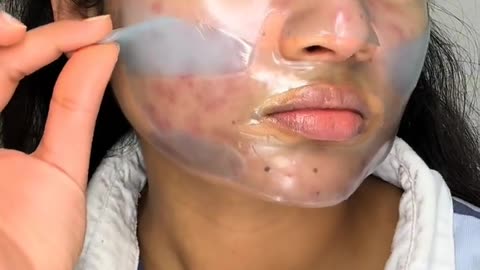 To achieve your ideal skin