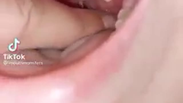 OMG!!! Unbelievable, the reason you have bad breath