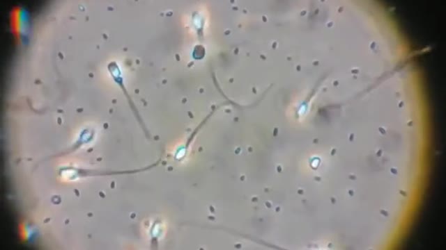 Sperm under microscope