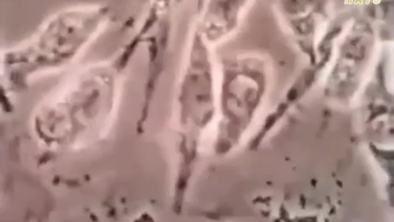 Footage of flouride killing cells. Share to let everyone know