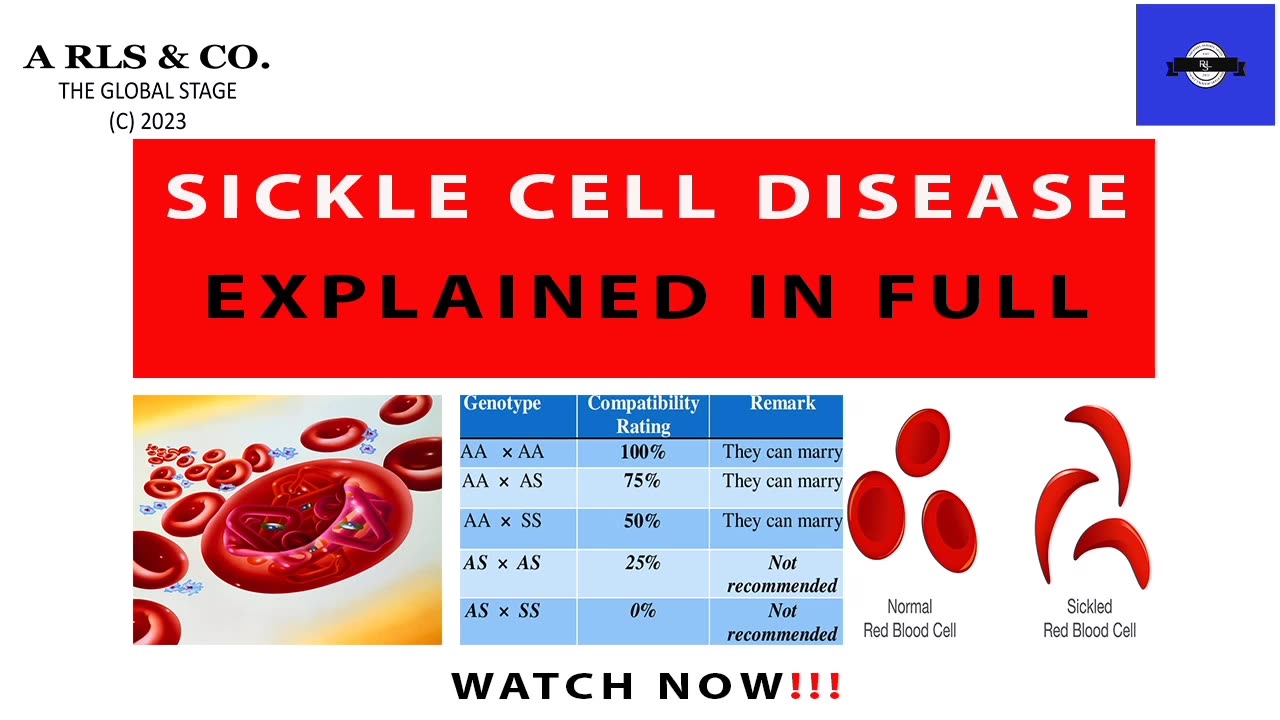 SICKLE CELL DISEASE MADE SIMPLE TO UNDERSTAND