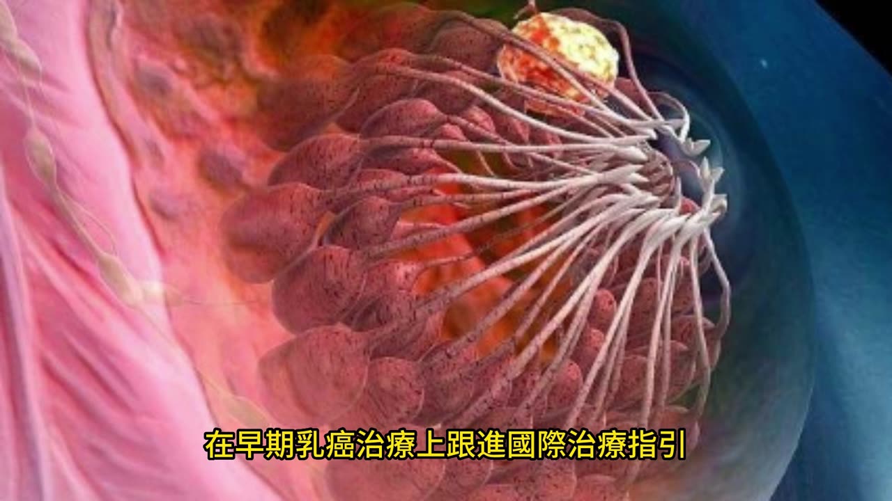 荷爾蒙陽性早期乳癌 有2~3成復發風險