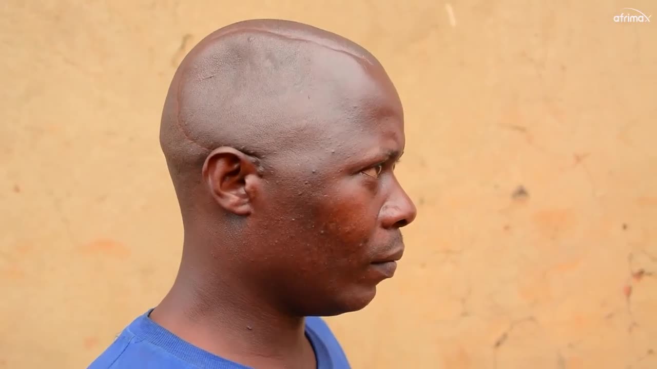 A Man in Africa with Half A Head