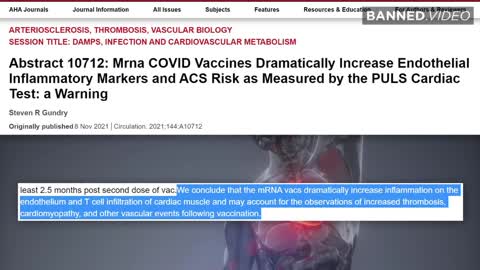 Proof Covid-19 Vaccines Cause Cardiovascular Disease
