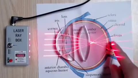 Wonderfully explained how your eyes, glasses and the reflection/refraction works in the eyes.