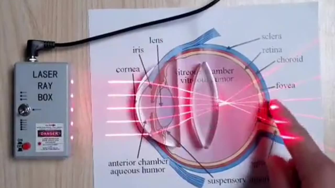 Wonderfully explained how your eyes, glasses and the reflection/refraction works in the eyes.