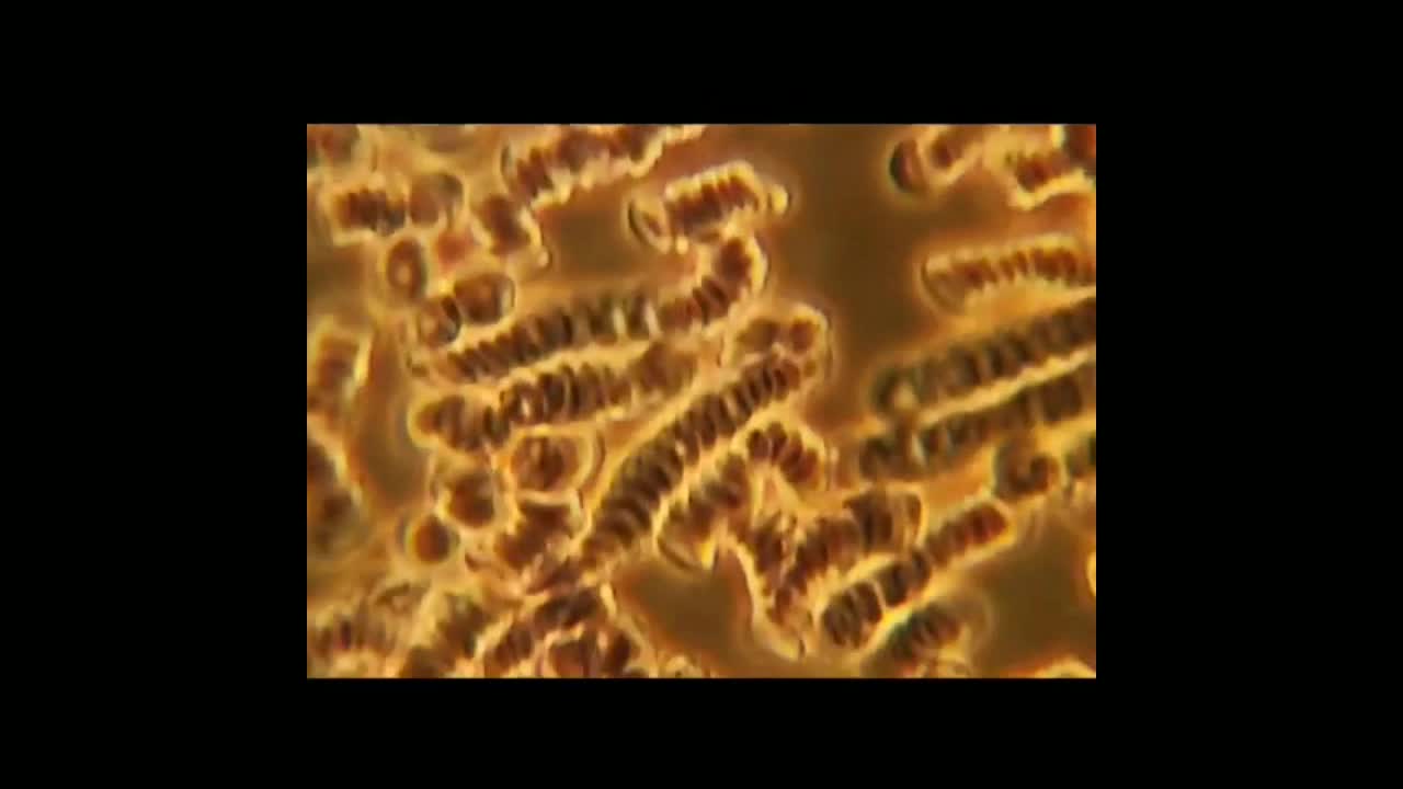 혈액 비교 (접종&비접종)