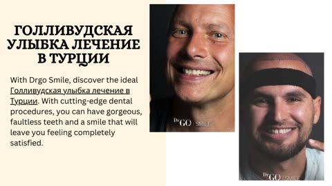 ⁠Голливудская улыбка лечение в Турции