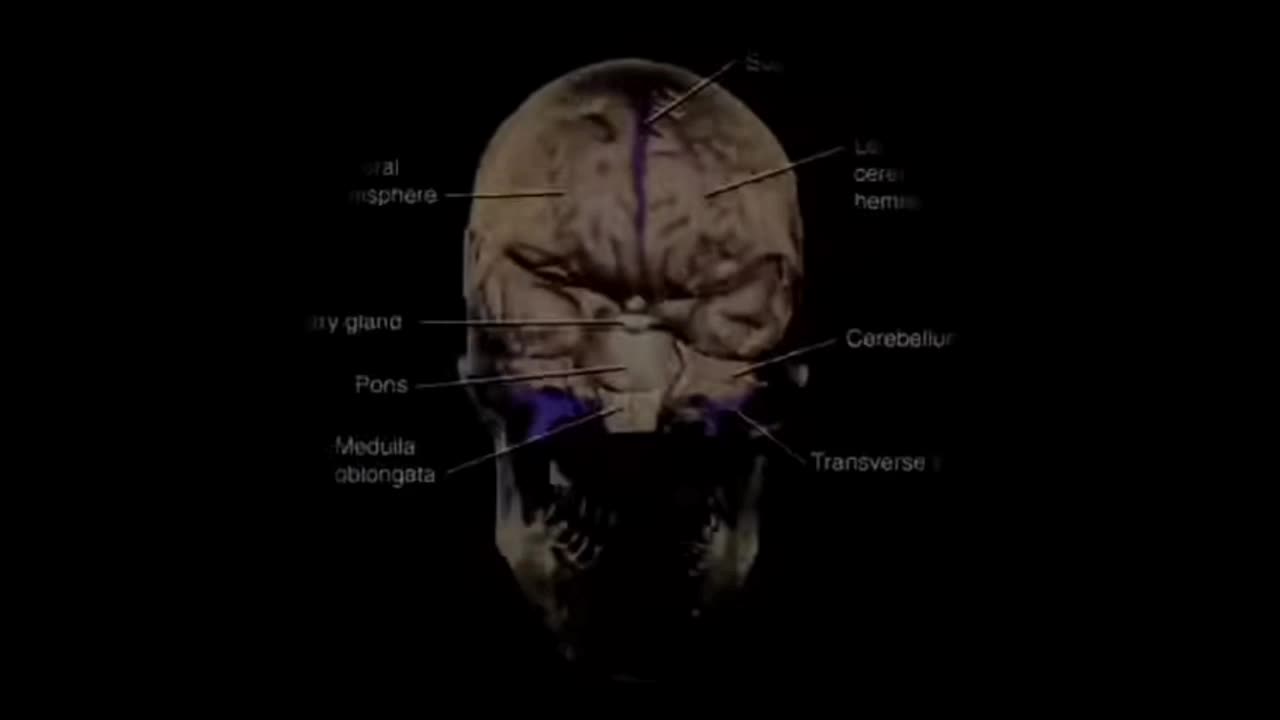 EMF Inhibit MELATONIN Production. *3min