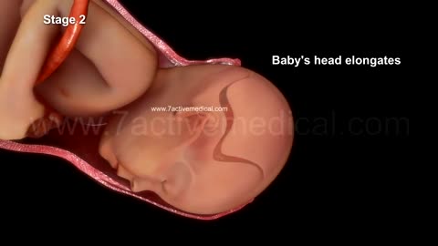 AMAZING NORMAL LABOR & VAGINAL BIRTH