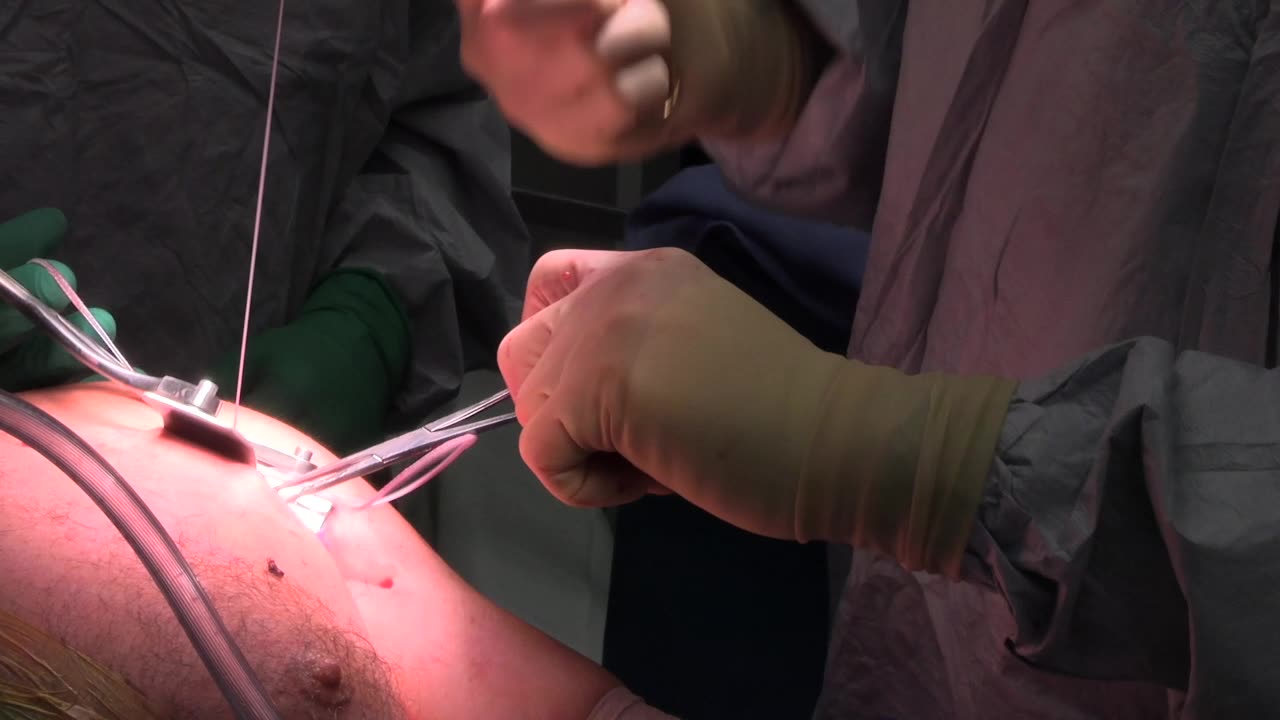 PECTORAL TENDON