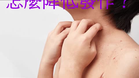 異位性皮膚炎 怎麼降低發作？