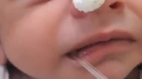 tube in mouth of baby of new born baby2023