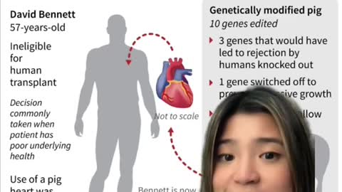 A man just got a pig heart transplant