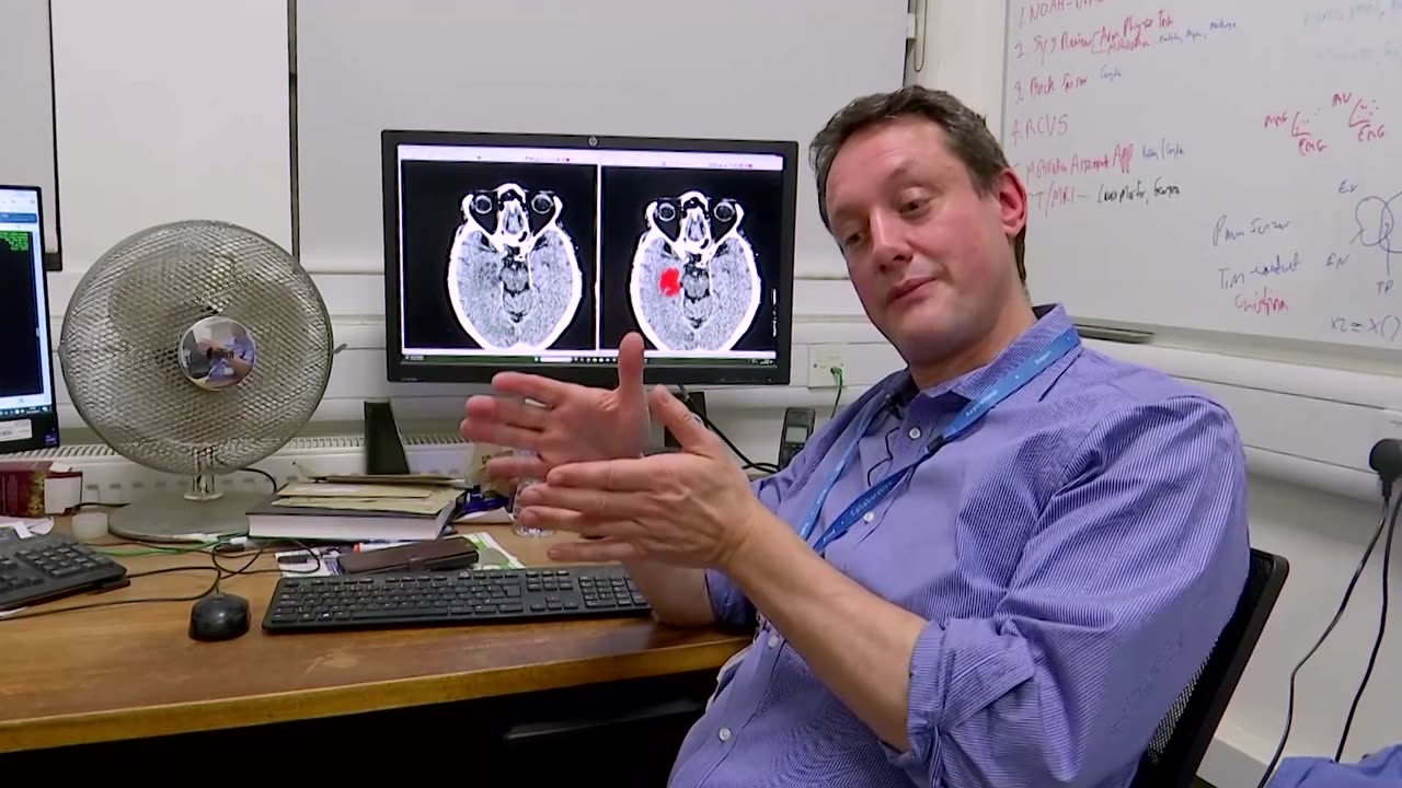 New AI software could double stroke diagnosis accuracy