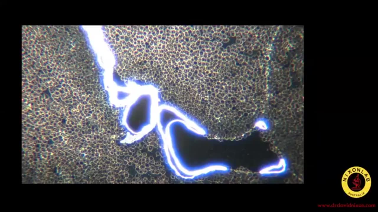 INJECTIONS, BLOOD; SELF-ASSEMBLED QUANTUM DOTS (Dr. David Nixon)