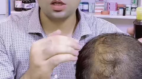 Hair loss problem finish. One time must u try