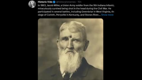 Union Soldier Survived Being Shot In the Head