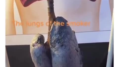 What smoking does to your lungs