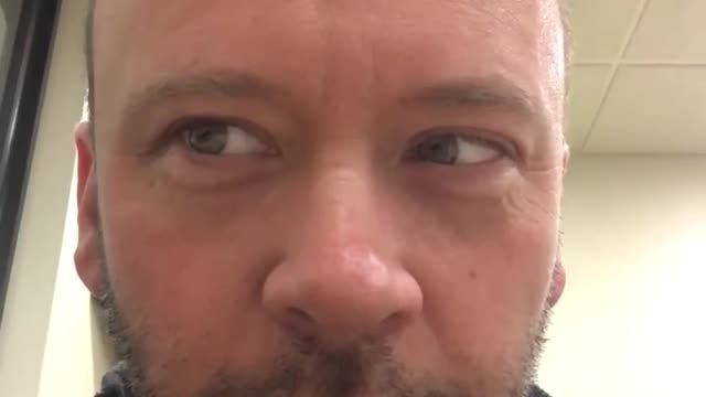 Crazy video of mans eye not following other eye's movement.