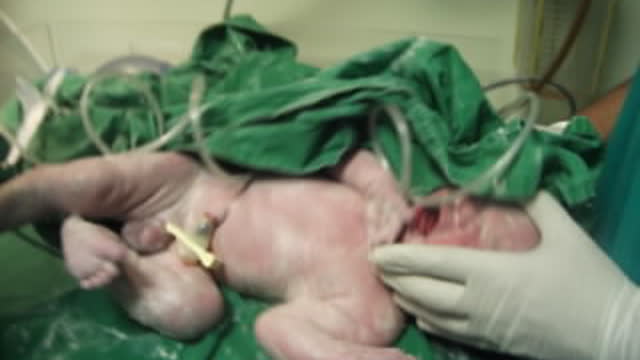 The process of leaving a child directly to life. Direct birth.