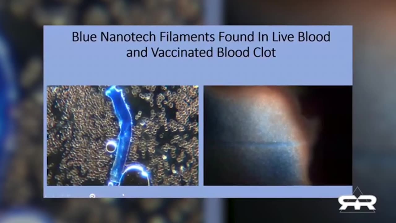 NANOTECHNOLOGY HAS MADE IT INTO THE BLOOD OF VAXXED/UNVAXXED