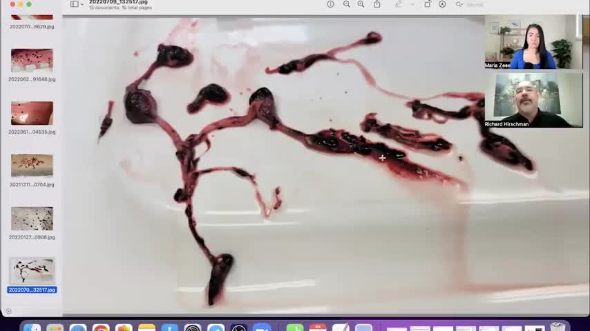 RICHARD HIRSCHMAN - WARNING: EXTREMELY GRAPHIC! STRUCTURES KILLING INJECTED 1 YEAR AFTER SHOT