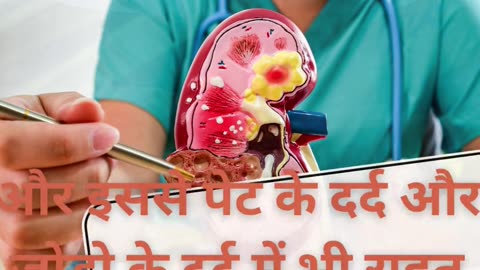 गुर्दे की पथरी का उपाय | Kidney Stone Remove #kidneystone #homeremedies #ayurveda