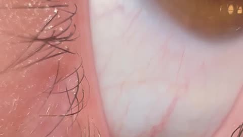 Unique Eye Iris