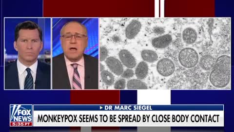 A "rare" disease called monkeypox has been spreading all over the world.