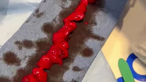 This video was taken by a heart surgeon on a 40 year old vaccinated athlete...