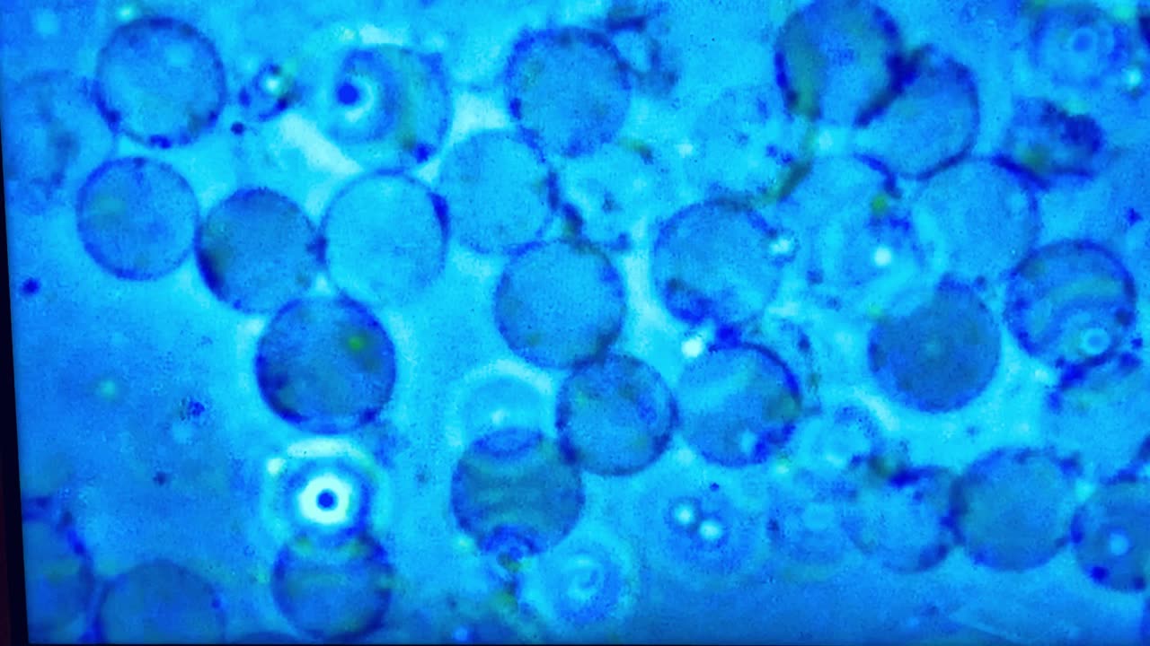 930 hours after slide preparation - non-biological designed microbotes are still having a party