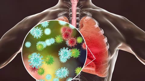 TOP 8 MOST COMMON AND SERIOUS ADVERSE REACTIONS TO COVID VACCINES