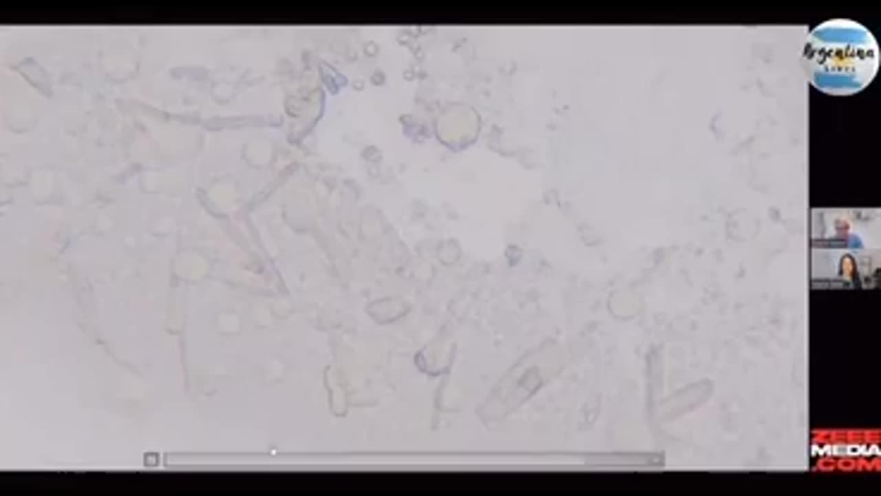 ORO COLOIDAL DISUELVE Y DECINTEGRA LA NANOTECNOLOGIA INCERTADA EN LA SANGRE DE LOS VACUNADOS