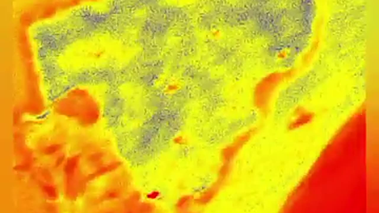 Nanotechnology in my bloodstream documentary part 1