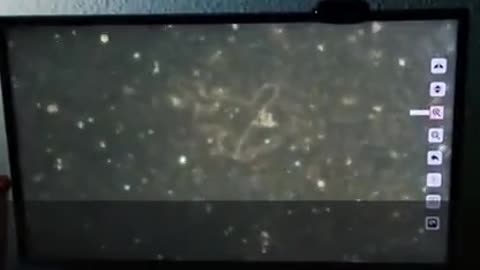 m_RNA blod work