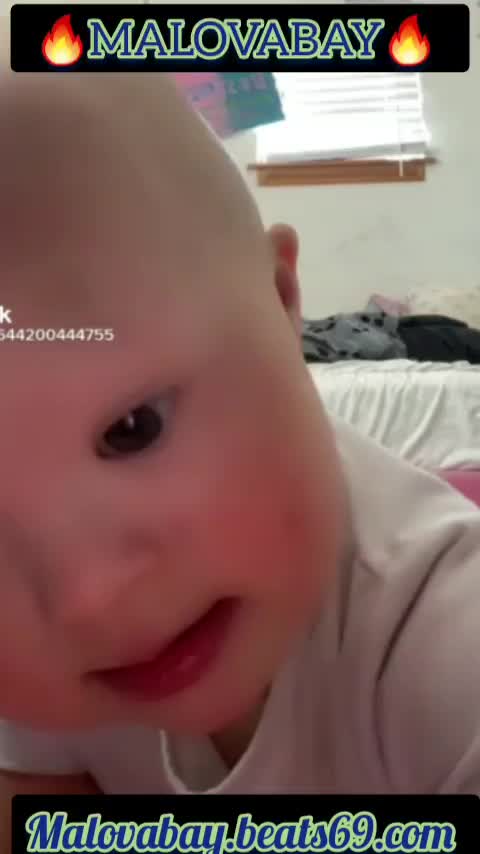 Trump Said This Baby Was The Cutest Pin Head He Has Ever Seen LOL Watch This!