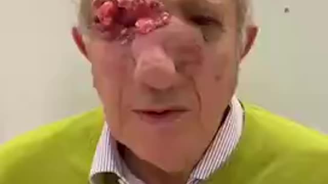 Man got two plus jabs and look what happened after