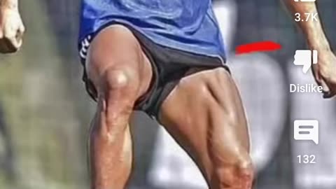 Leg muscles of footballer