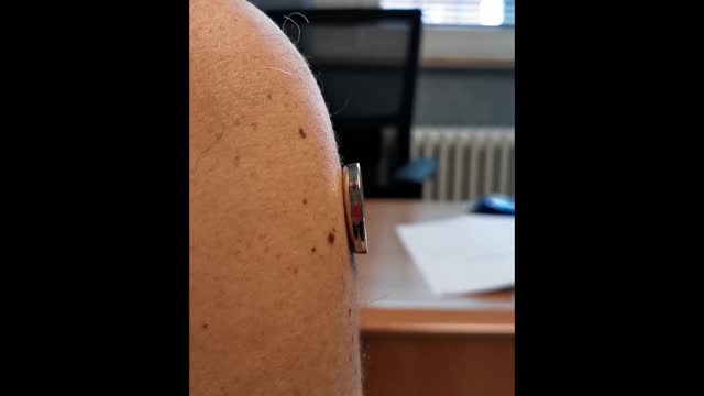 Perchè i Magneti si attaccano nel punto in cui è stato inoculato il vaccino per il Covid?