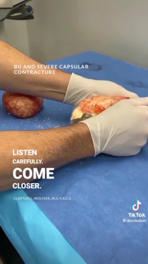 DANGER about breast implants