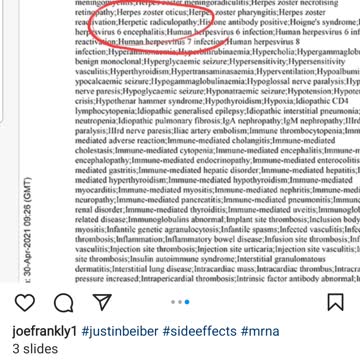 Justin beiber cancels tour