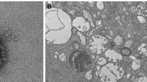 Explosive Evidence Virology a Global Lie NO COVID19 SARS-CoV-2 Exists